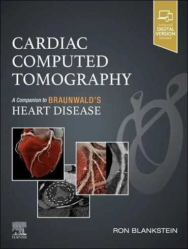 دانلود کتاب Cardiac Computed Tomography: A Companion to Braunwald’s Heart Disease